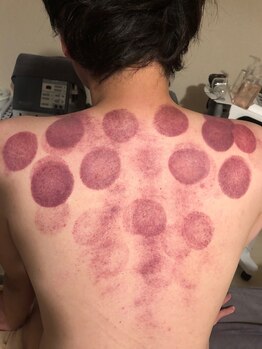 中国整体 らくらく堂/首・肩こり解消