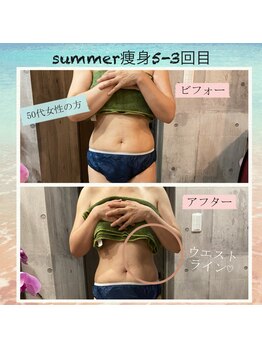 ランプ(Lampe)/◇summer痩身5回コース3回目◇