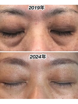 ポノ(pono)/ここまでに！