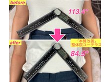 ユーテラス/産後ケアで肋骨の開きが改善！