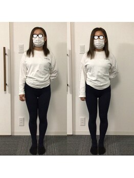 プライベート整体院 アイリー(IRiE)/太ももスッキリ、脚長効果も◎