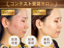 エステティックサロン キュビア(Cubia)