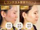 エステティックサロン キュビア(Cubia)の写真