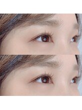 アルビス バイ エニーハウ(Arbis by anyhow)/最新マツエク★LEDエクステ