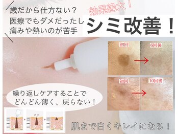 カミーシャ(KaMi-Sha)