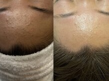 ラニブロウ(Lani brow)/艶肌アンプルワックス♪