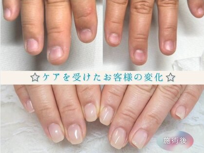 ベアソウル(Bare Soul)の写真