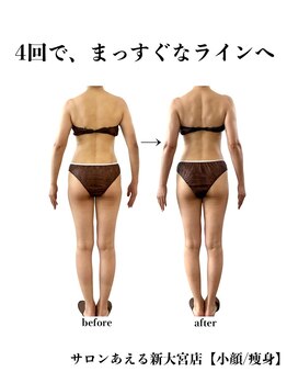 サロンあえる 新大宮店/手足が真っ直ぐに