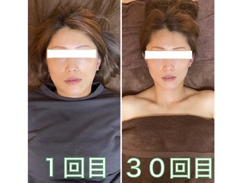 トータルボディケア サニー(TOTAL BODY CARE)/産後ケアとダイエット