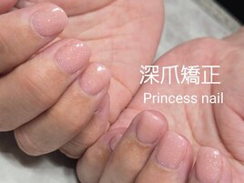 深爪矯正ベーシック12,000
