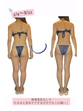 エステティック アントワネット/３２歳女性ビフォーアフター☆