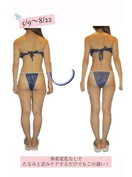 エステティック アントワネット/３２歳女性ビフォーアフター☆