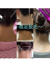 ソラ(sora)/襟足脱毛