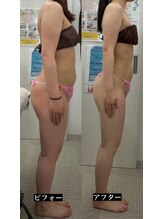 メリアミーゴ(Meli amigo)/下半身痩せ・むくみ改善