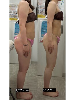 メリアミーゴ(Meli amigo)/下半身痩せ・むくみ改善