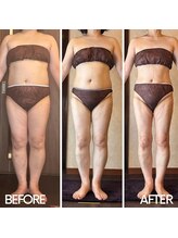 アーユルヴェーダアンドアロマエステ アユス(AYUS)/【50代】19キロ減量達成