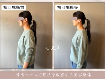 ほぐし屋 かすがい/初回/猫背巻き肩矯正