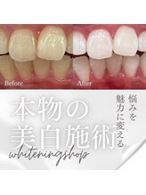 ホワイトニングショップ 太子店/確実に歯が白くなる専門店