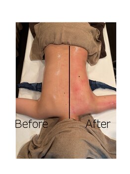 白美/痩身／運動が苦手な方にも◎