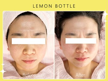 シロカネ 光の森店(SHIROKANE)/レモンボトル☆