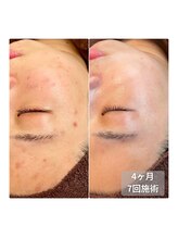 アイビーケア 三田(ivy care)&nbsp;肌管理フェ イシャル