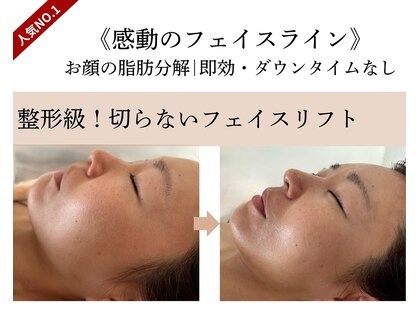 エルブラン(Herb ame)の写真