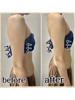 エンチャント(ENCHANT)/プルプル腕はもう嫌