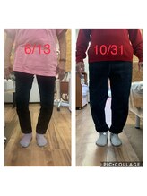 カインド整体院(KiND整体院)/高齢でもO脚が変わりました！