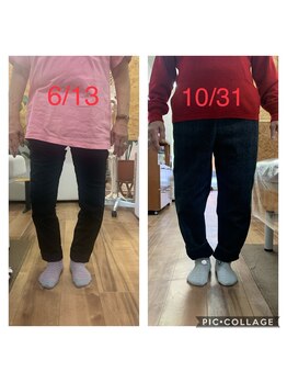 カインド整体院(KiND整体院)/高齢でもO脚が変わりました!