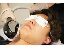 メンテ(MENTE)/脱毛したいけど...。