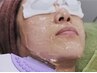 【顔のW脱毛】　毛穴汚れもすっきり!フェイスwax＋光脱毛 パック付き