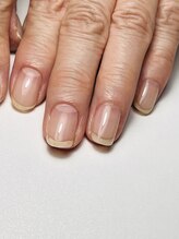 アイネイル(Ainail)/自爪育成コース2回目の方