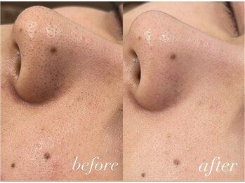 ナビレラ 自由が丘(Navillera)/プレミアム構造ワックス