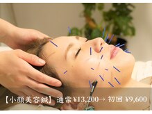 アモ(amo)/小顔美容鍼