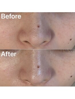 エイミー(Amy)/Before&After