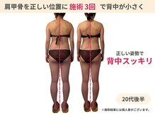 ラルーエ 仙台/施術3回で背中が小さく変化！