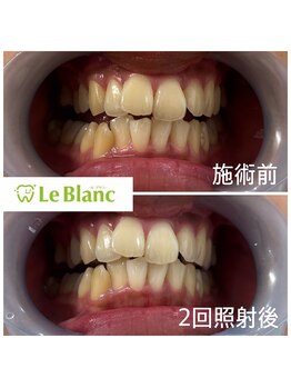 ルブラン 奈良店(Le Blanc)/ブライダル前にも♪