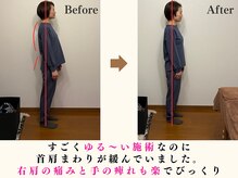 ピースフルポイント(Peaceful Point)の雰囲気（姿勢を整えることで肩や首の不調も改善していきます。）