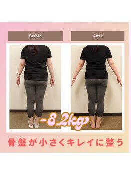 えのもと美容整体院の写真/代謝をUPさせることでスルッと痩せやすい身体作り◎ダイエット継続率もUP！健康的に美しいボディラインに♪