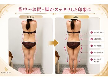 ラディア ボディ(Radia Body)の写真/ぽっこり・むくみ・姿勢崩れに。全身すっきりサイズダウン! ハイスペック美容マシン【メディライン】