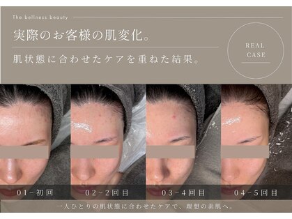 ザ ベルネスビューティー(The bellness beauty)の写真