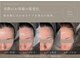 ザ ベルネスビューティー(The bellness beauty)の写真
