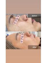 サロン ウイ(salon u'i)/～リブセラ～