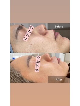 サロン ウイ(salon u'i)/~リブセラ~