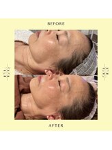 ビューティサロンエクレル (Beauty Salon Eclair)/肌質改善・肌管理