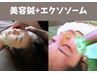 【イチ押し】エクソソーム+美容鍼で肌細胞を－10歳 初回限定23100円→20000円