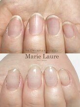 マリーロール 淀屋橋本店(Marie Laure)/自爪育成/深爪矯正/ネイルケア