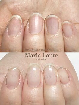 マリーロール 淀屋橋本店(Marie Laure)/自爪育成/深爪矯正/ネイルケア