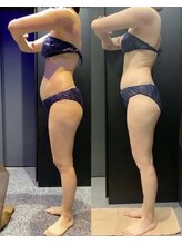 エステティック レイビス 銀座店(RAYVIS)/痩身効果写真