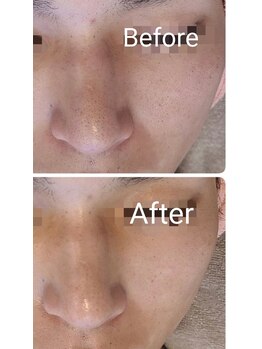 サロン ド ハニー(Salon de Honey)/